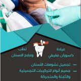 دكتورة سوزان عفيفى اسنان في القاهرة المقطم